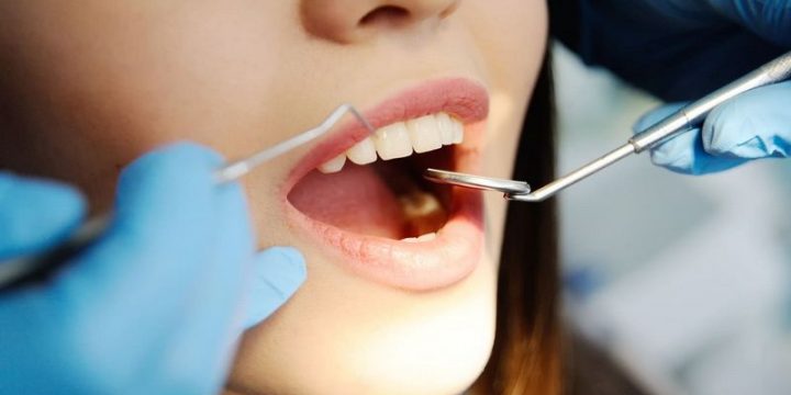 П’ять порад для здоров’я зубів та красивої усмішки