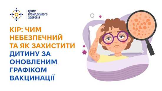 Кір: чим небезпечний та як захистити дитину за оновленим графіком вакцинації